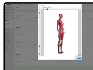 Screenshot von Optica Viva auf einem Laptop mit geöffnetem Bodychart-Dialog, der ein weibliches anatomisches Muskelmodell in der Seitenansicht zur Befunddokumentation zeigt.